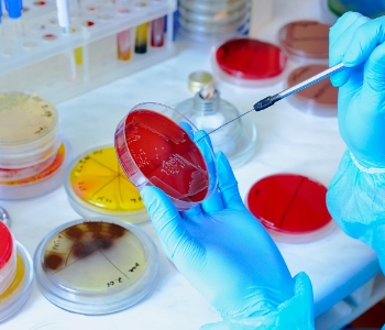 Microbiological Analysis